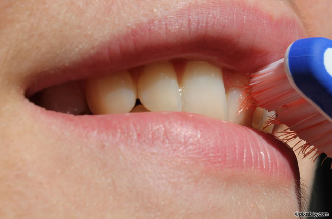 Verborgene Zahnimplantate